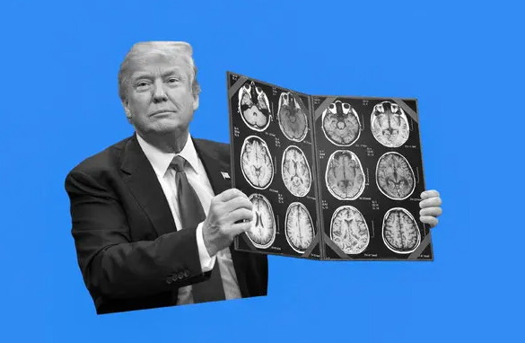 A black-and-white image of a political figure holding up brain scan images against a bright blue background.